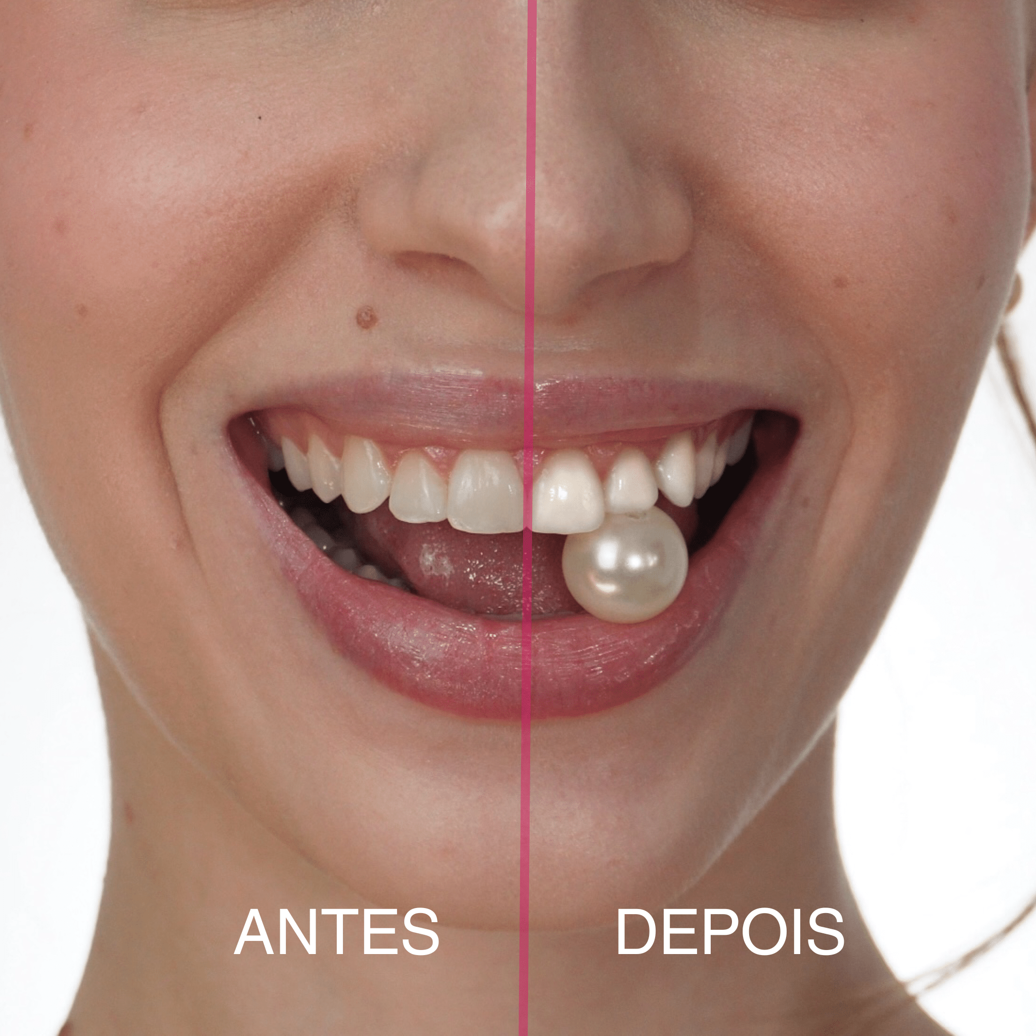 Fita Clareadora Smilie - Smilie